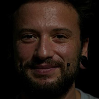 Técnica de aumento peniano atrai homens trans estrangeiros ao Brasil