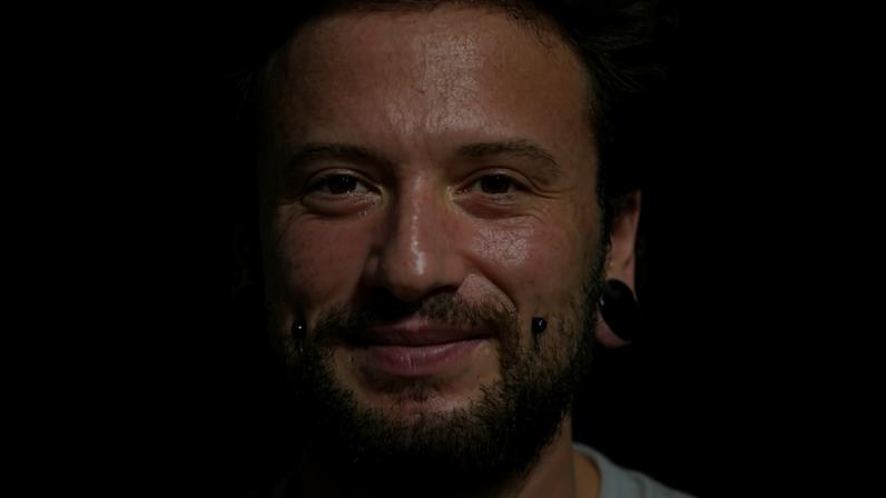 O italiano Giacomo Furfori veio ao Brasil para se submeter a uma cirurgia de redesignação sexual com uma técnica desenvolvida por pesquisadores brasileiros; o procedimento foi realizado em março, em Salvador