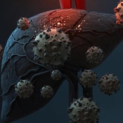Inflamação no fígado: sintomas que não devem ser ignorados