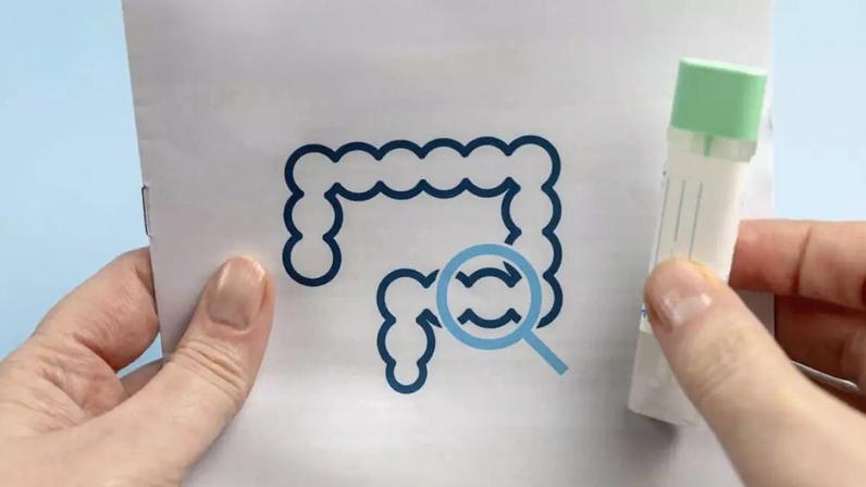 O rastreamento é essencial para prevenir e tratar eficazmente o câncer colorretal: apesar das novas diretrizes, colonoscopia ainda é o exame recomendado para quem está em risco aumentado ou tem risco médio de desenvolver a doença. Varlay/iStock via Getty Images Plus