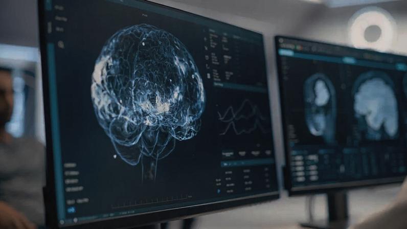 Uma pesquisa publicada na Nature Neuroscience identificou dois subtipos de autismo baseados na conectividade cerebral. Entenda o que muda para o diagnóstico