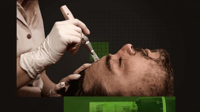 ‘Microneedling consists of taking tiny needles and sticking them into your skin, mostly on the face but sometimes elsewhere on your body,’ writes Gideon Meyerowitz-Katz.