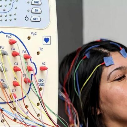 Estudo liga glucosamina ao Alzheimer e levanta alerta sobre suplemento