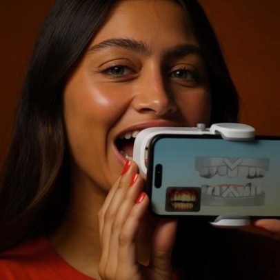 SouSmile lança monitoramento remoto com IA inédita no Brasil