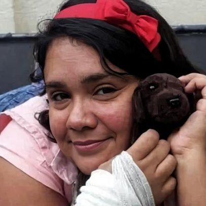 Mulher que fingia ser criança é acolhida com 200 marcas de agulhas
