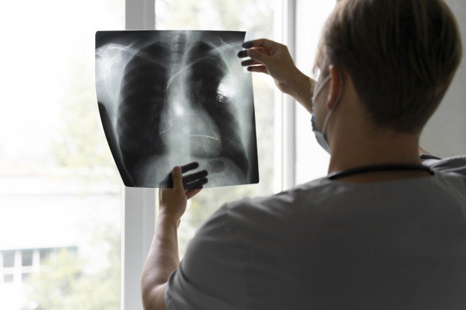 Agora, o gene TP53 passou a ser incluído nos laudos médicos - (crédito: Freepik)