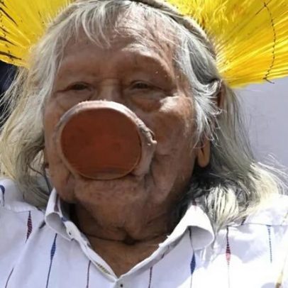 Cacique Raoni apresenta melhora, mas permanece na UTI