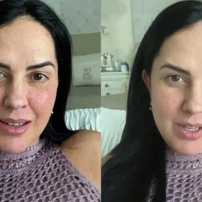 Graciele Lacerda comenta resultado de biópsia após filha retirar nódulo