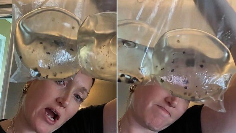 Lauren encontrou mofo nos implantes mamários — Foto: Reprodução/TikTok