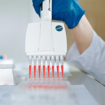 Nova estratégia promete tratamento para leucemia resistente à quimioterapia