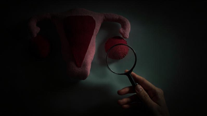 Da parte feminina, as causas mais frequentes de infertilidade são os distúrbios ovulatórios