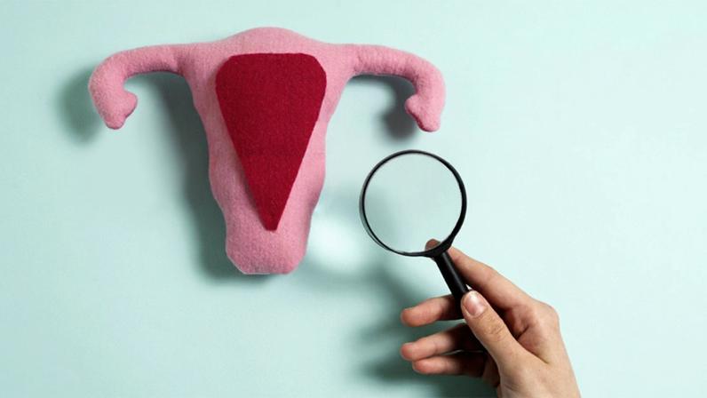 Mudança busca ampliar a compreensão sobre uma condição que afeta milhões de mulheres e vai além dos ovários – Foto: Magnific