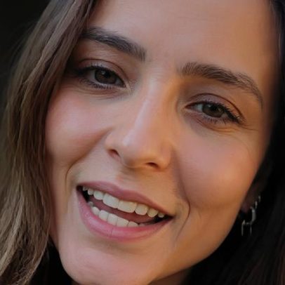 Larissa Manoela encara cirurgia para endometriose aos 25 e desmente gravidez