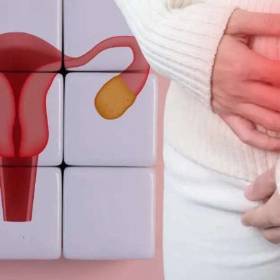 Sinais pouco percebidos do câncer de ovário: barriga inchada e mais sinais