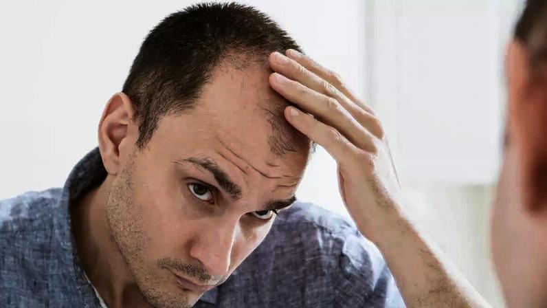 Minoxidil causa impotência / Foto: Shutterstock