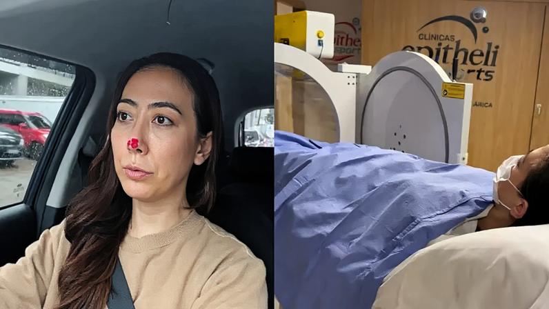 Juliane Massaoka atualiza os fãs sobre infecção causada pela injeção não autorizada de PMMA em rinoplastia