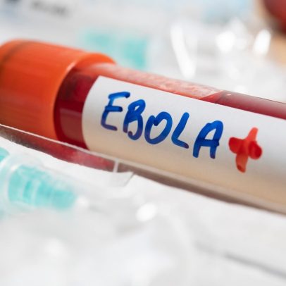 Suspeita de Ebola em SP mobiliza equipes; exame revela outra doença