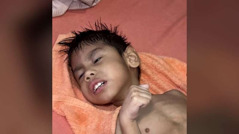 Sem recursos para o tratamento, criança vegeta em cama após uma queda da escada