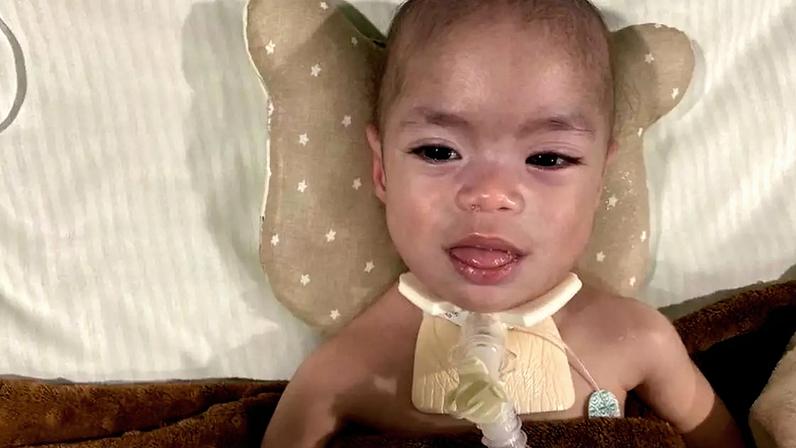 A luta de Matteo: uma mãe e a esperança por um tratamento contra a Doença de Pompe