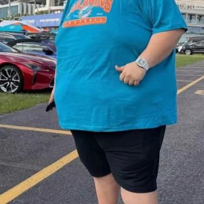 Gordão da XJ revela antes e depois de perder 130 kg