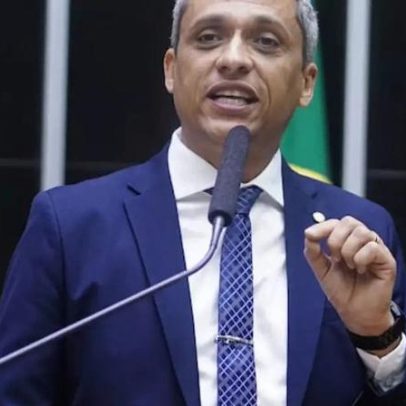 Deputado Gustavo Gayer é internado para tratar obstrução intestinal