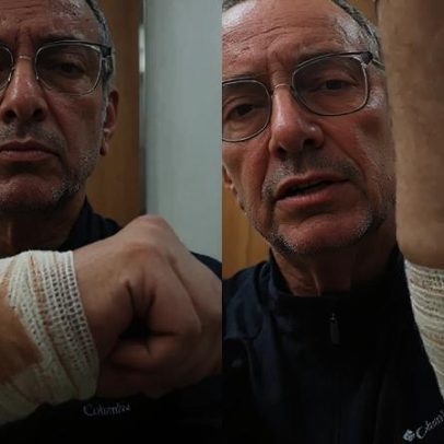 Jornalista da Globo fica gravemente ferido após ataque de pitbull