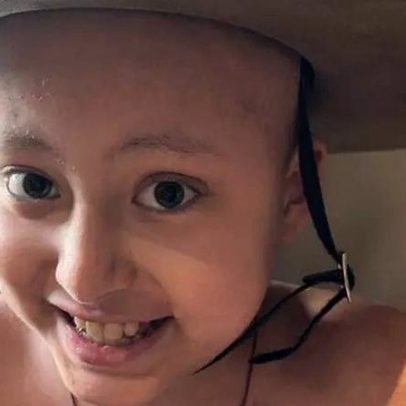 Tratamento CAR-T pode salvar Miguel