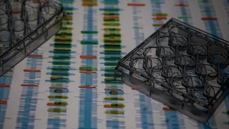 Photograph: Tek Image/SCIENCE PHOTO LIBRARY/Getty Images/Science Photo Library RF