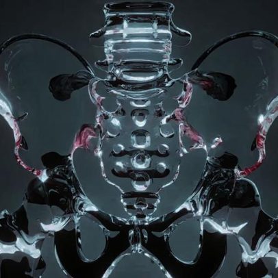 Cirurgia robótica amplia opções de tratamento para endometriose