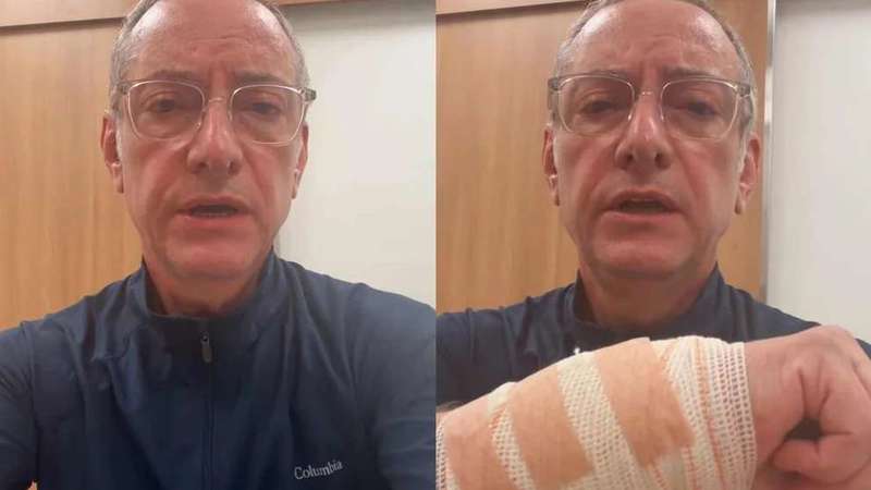 Jornalista precisou de quatro pontos na mão