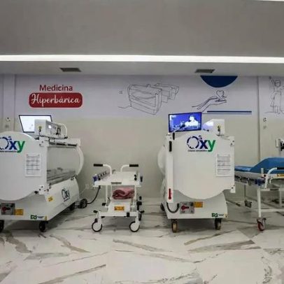 Hospital lança cartilha para evitar acidentes com queimaduras