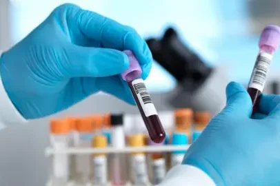 Dois possíveis casos de Ebola no Brasil descartados após testes negativos