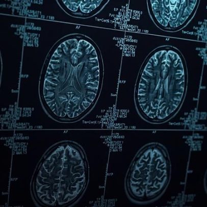 Antidepressivos e antipsicóticos podem substituir opioides, aponta estudo