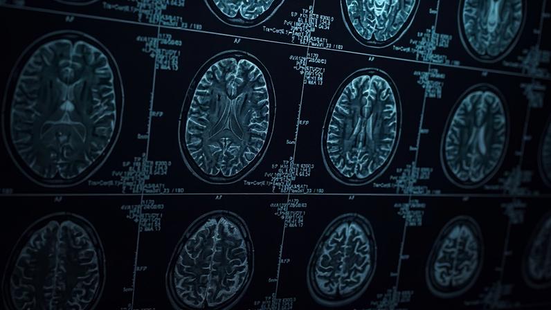 The study examined common pain medications like acetaminophen and ibuprofen, but also the promise of other drugs like ketamine and antipsychotics for pain relief.