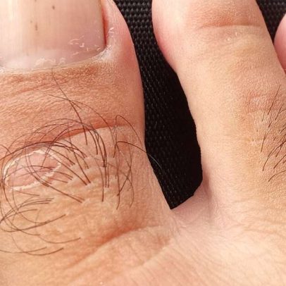 Pelos nos dedos dos pés podem indicar boa circulação sanguínea