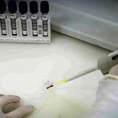 Secretaria de Saúde de São Paulo investiga novo caso suspeito de Ebola
