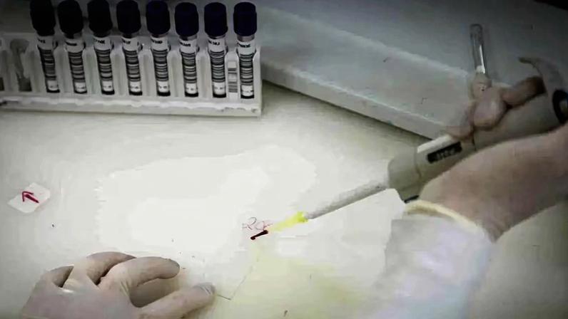 Brasileira voltou ao país em 6 de junho e apresentou sintomas como diarreia e febre