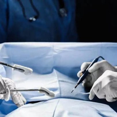 Fatores que influenciam a complexidade de um transplante