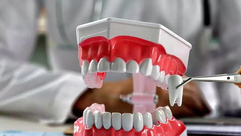 Presente em grande parte da população, o siso pode não encontrar espaço suficiente na arcada dentária e gerar complicações