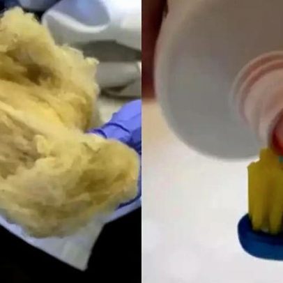 Pasta de dente com cabelo? Pesquisadores discutem reconstrução dentária