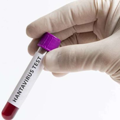 Ebola e hantavírus podem se agravar em dias, apontam especialistas