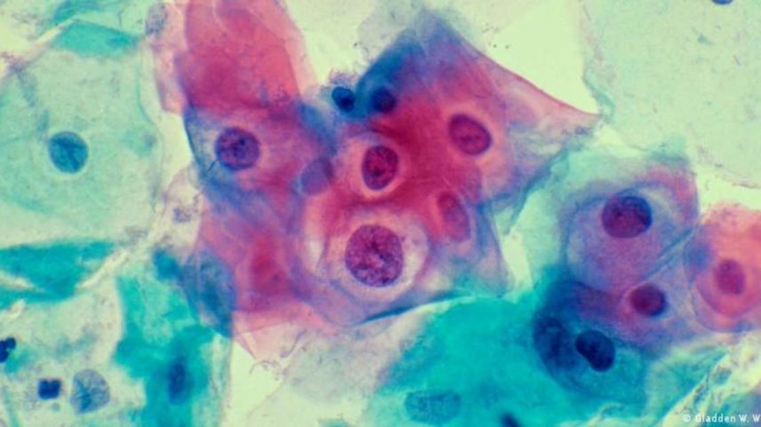 O HPV é uma das doenças sexualmente transmissíveis mais comuns