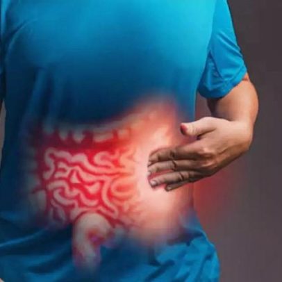 Síndrome do Intestino Irritável: conheça os sintomas