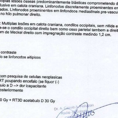 Priscilla enfrenta metástase grave que afeta sua vida e a dos filhos