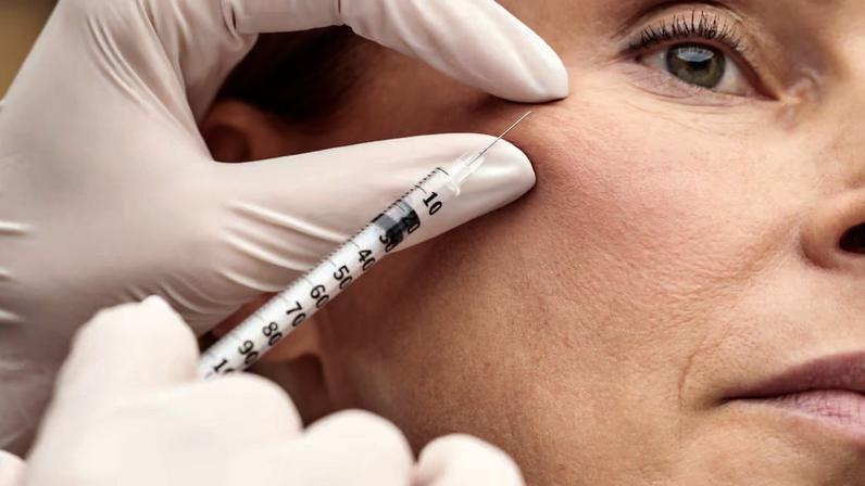 Morte recente por PMMA reacendeu o debate sobre a segurança e os limites da estética