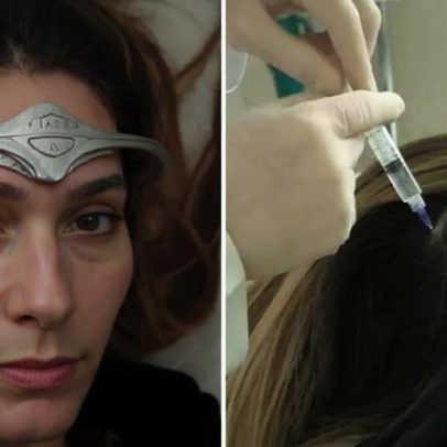 Virginia Fonseca paga caro por tratamento delicado na cabeça; saiba o custo