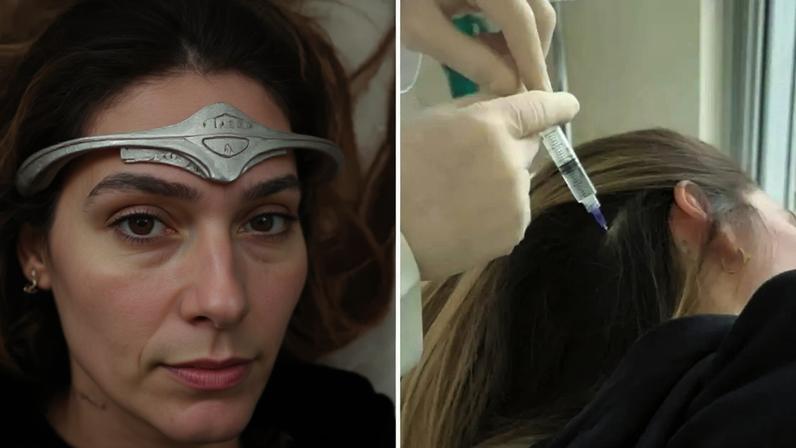 Virginia Fonseca passa por tratamento invasivo na cabeça