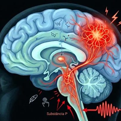 Falha cerebral mantém dor da fibromialgia persistente