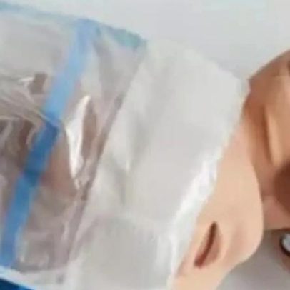 Mecânico revoluciona parto com truque simples de rolha e garrafa