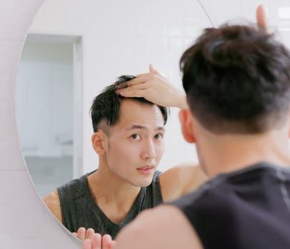 Perda de cabelo atinge homens mais jovens: o que saber e o que funciona